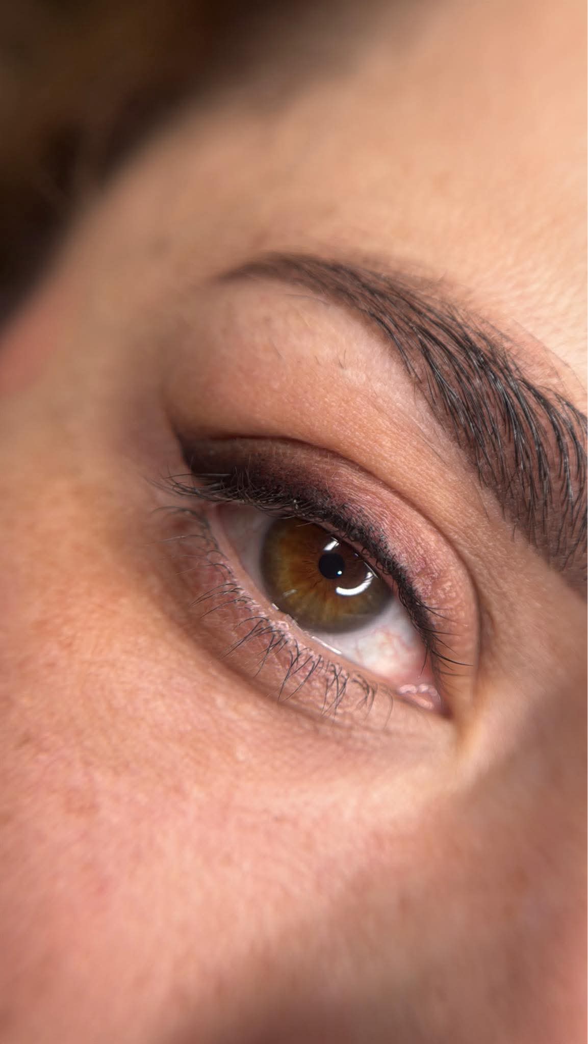Ojos antes